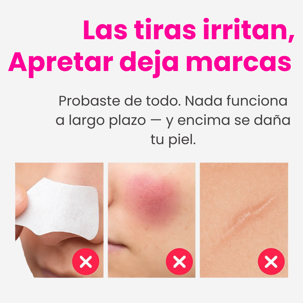 Aqualys™ Quita Puntos Negros con Doble Tanque de Agua