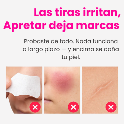 Aqualys™ Quita Puntos Negros con Doble Tanque de Agua