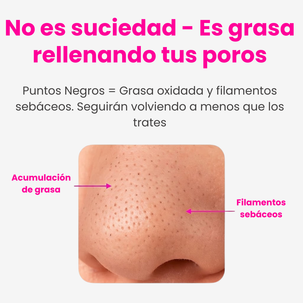 Aqualys™ Quita Puntos Negros con Doble Tanque de Agua