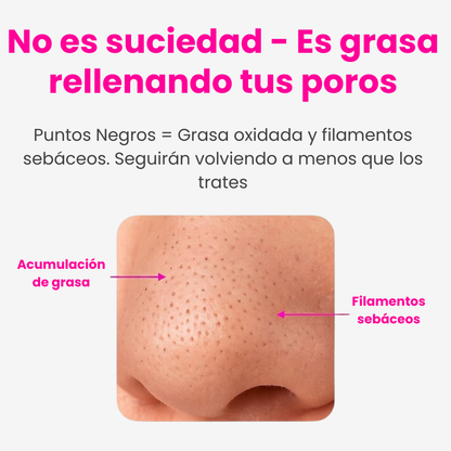 Aqualys™ Quita Puntos Negros con Doble Tanque de Agua