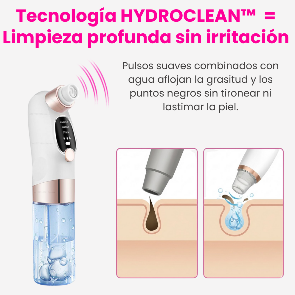 Aqualys™ Quita Puntos Negros con Doble Tanque de Agua