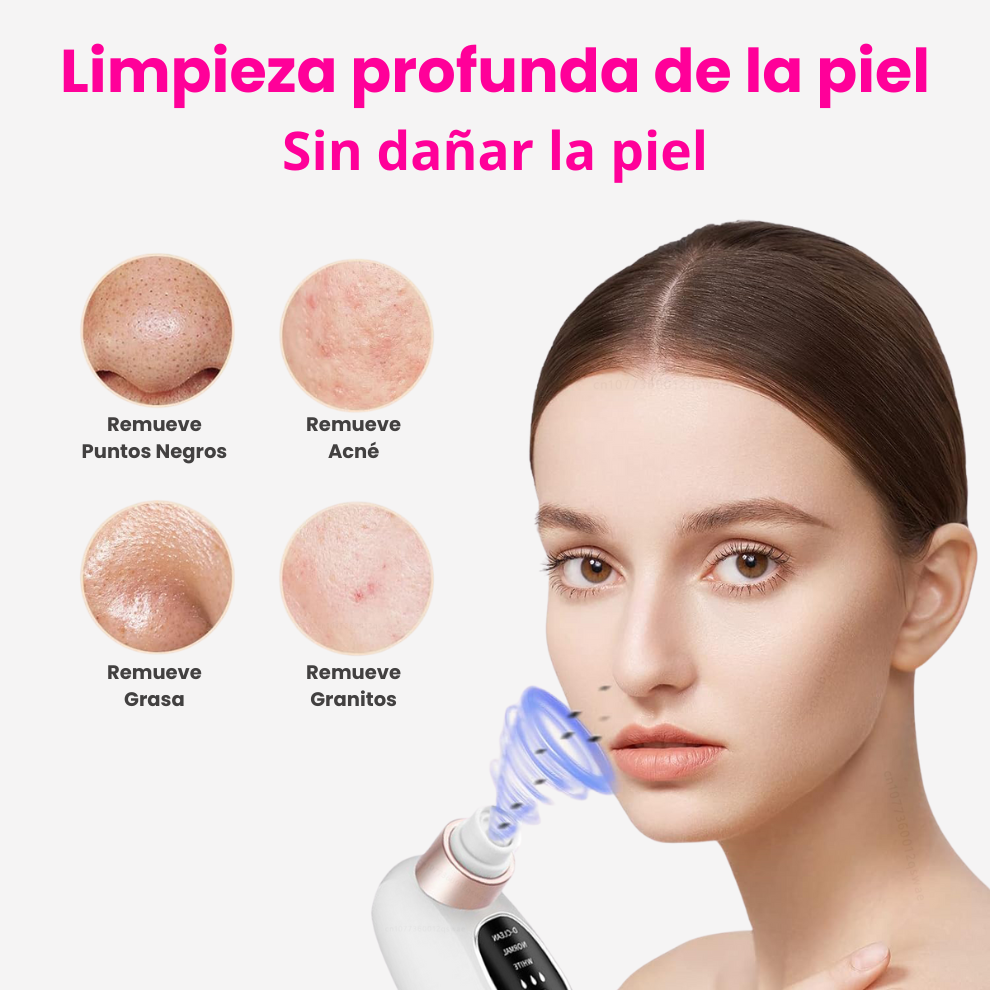 Aqualys™ Quita Puntos Negros con Doble Tanque de Agua