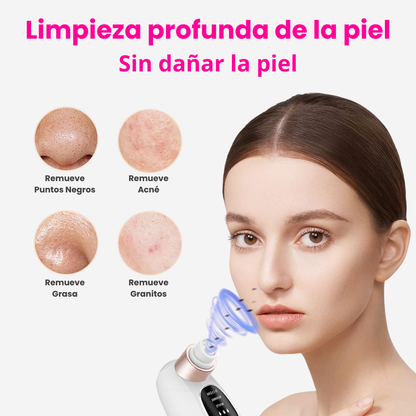 Aqualys™ Quita Puntos Negros con Doble Tanque de Agua